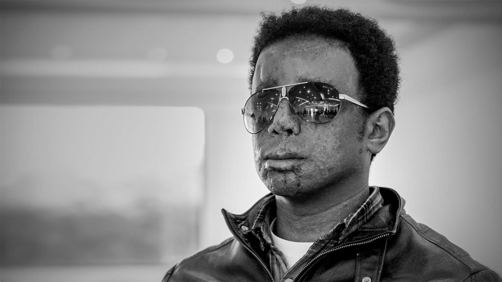 Édgar Bermúdez, el costo humano de la erradicación forzosa de coca