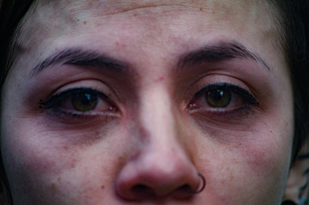La galería de los ojos irritados